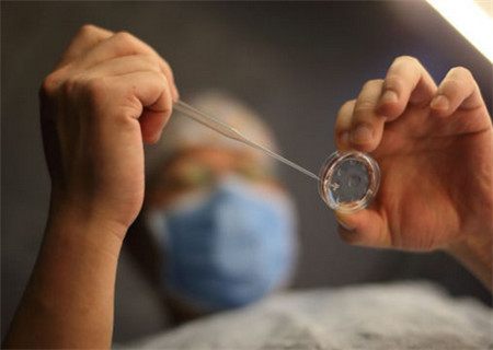 体外受精 IVF-ET